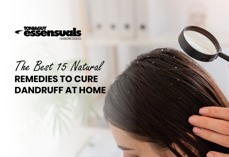 How to  Dandruff: 15 Natural Remedies at Home